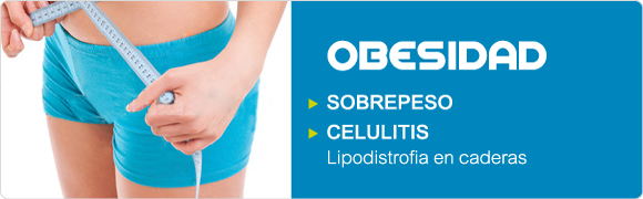 Tratamiento de la Obesidad con Acupuntura Zaragoza